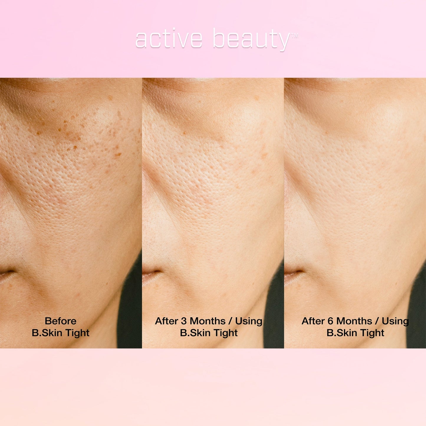 Skin Tightening Collagen Booster – B.Skin Tight 10 Pack Organic Wild Berry by Active Beauty®