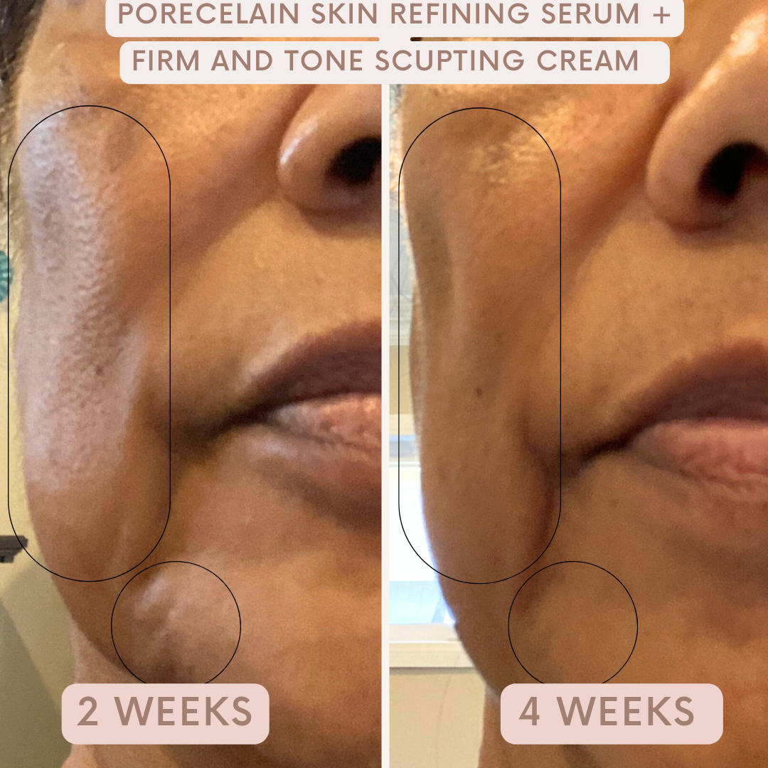 Firm & Tone Sculpting Cream by Auvê® Beauty