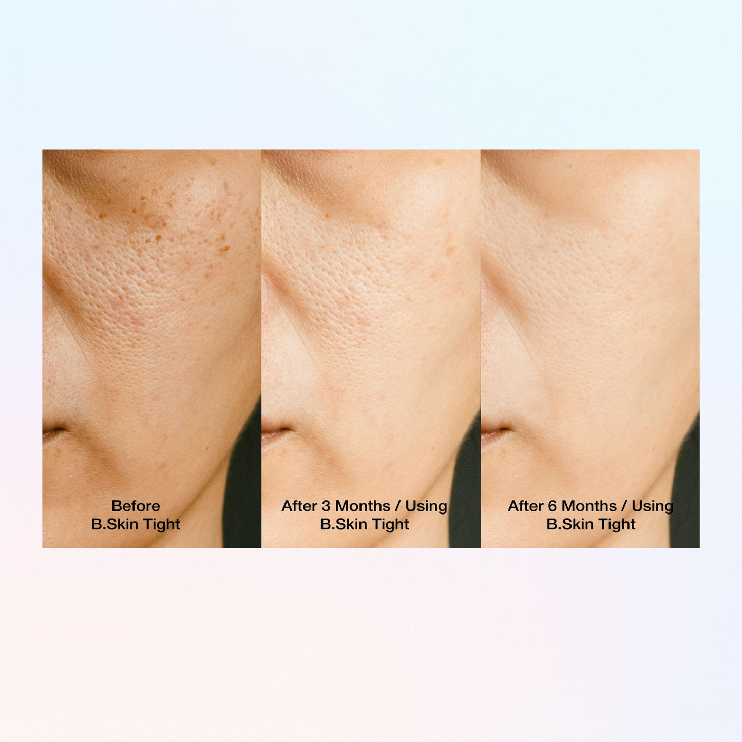 B. Skin Tight™ 9-in-1 Nutrient-Infused Marine Collagen + Electrolytes -  Antioxidant Wild Berry by Active Beauty