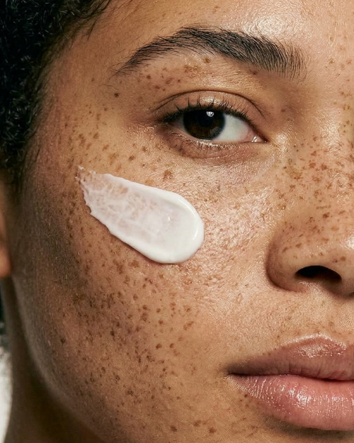 Close-up of a person's face with a white cream applied to the cheek.