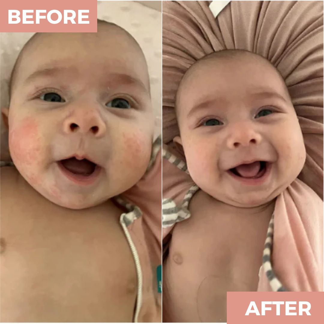 Nourishing Powder - Talc-Free Hypoallergenic Body & Face Powder for Sensitive Skin by NAPRIM Naturals