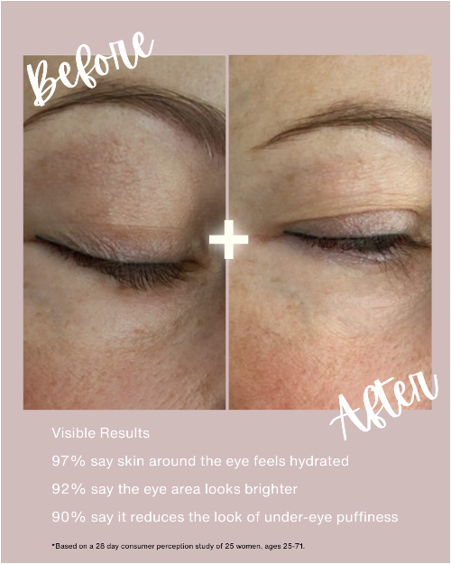 Before and after comparison of eye area skin with text indicating visible results.